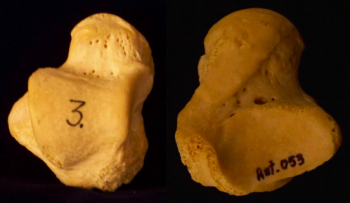 Figures: Bones of the Feet – Introduction to Human Osteology