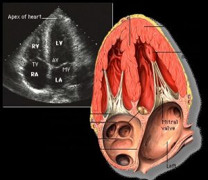 Apical view echocardiogram