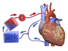 Heart lung machine