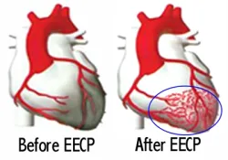 EECP training effect