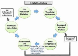 Systolic heart failure