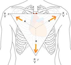 augmented voltage leads