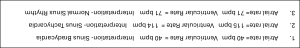 sinus rhythms test answers