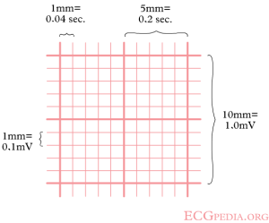 ECG grid paper