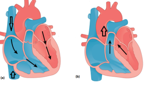 Preload and afterload