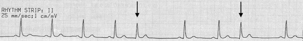 PJC. Interpret the rhythm