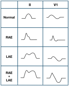 P wave morphologies