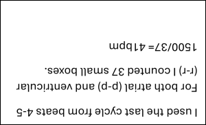 answer to sinus bradycardia Fig 8