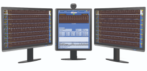 ECG monitor