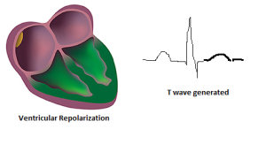 Ventricular Repolarization (T wave)