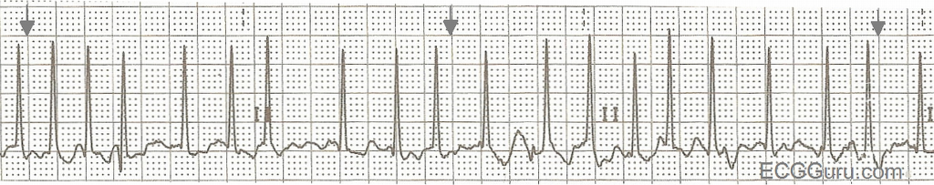 Practice rhythm