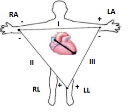 Einthoven's triangle