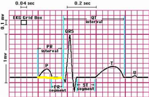 pr interval