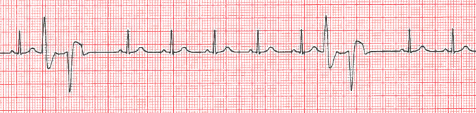 Fig 23 practice