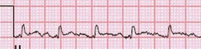 Case study exercise rhythm